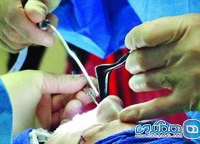 جراحی بینی در چه صورت با عارضه همراه است؟